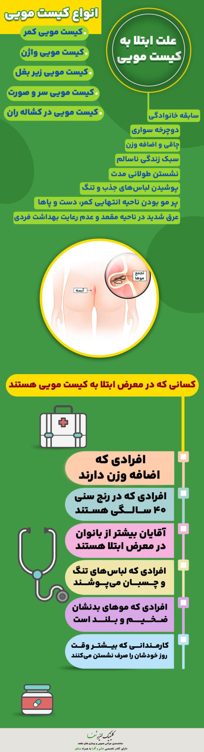 اینفوگرافیک کیست مویی چیست؟