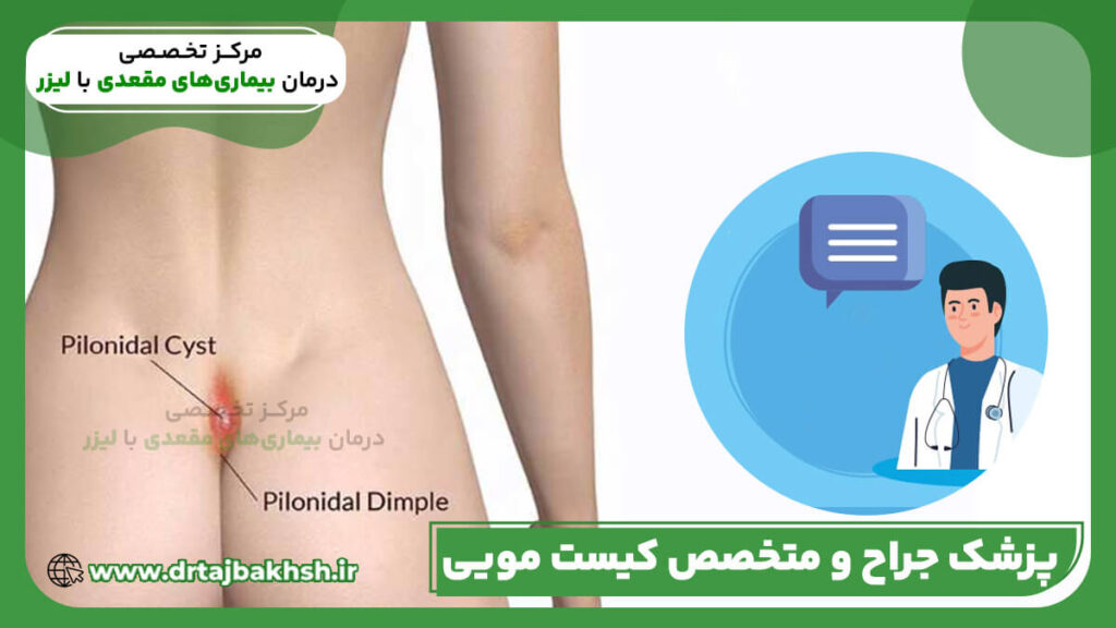 پزشک جراح و متخصص کیست مویی