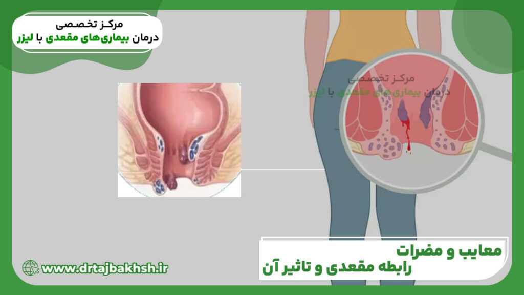 رابطه مقعدی یا سکس از پشت