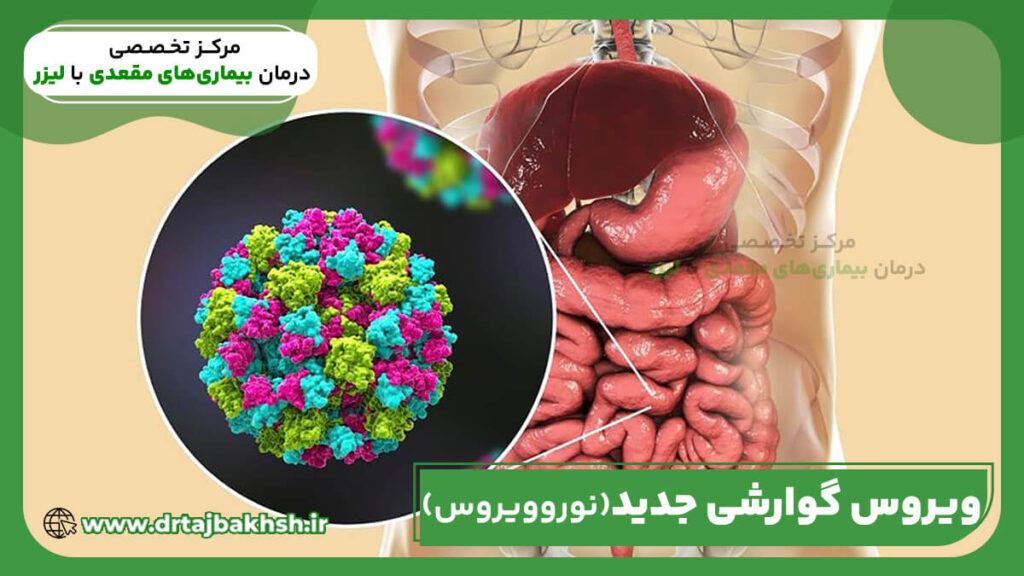 ویروس گوارشی جدید