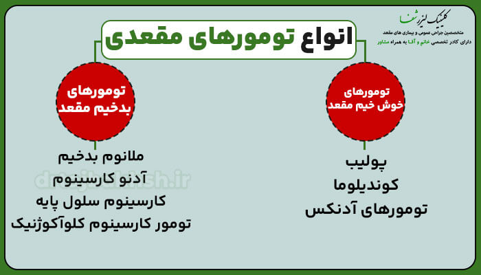 انواع تومورهای مقعدی