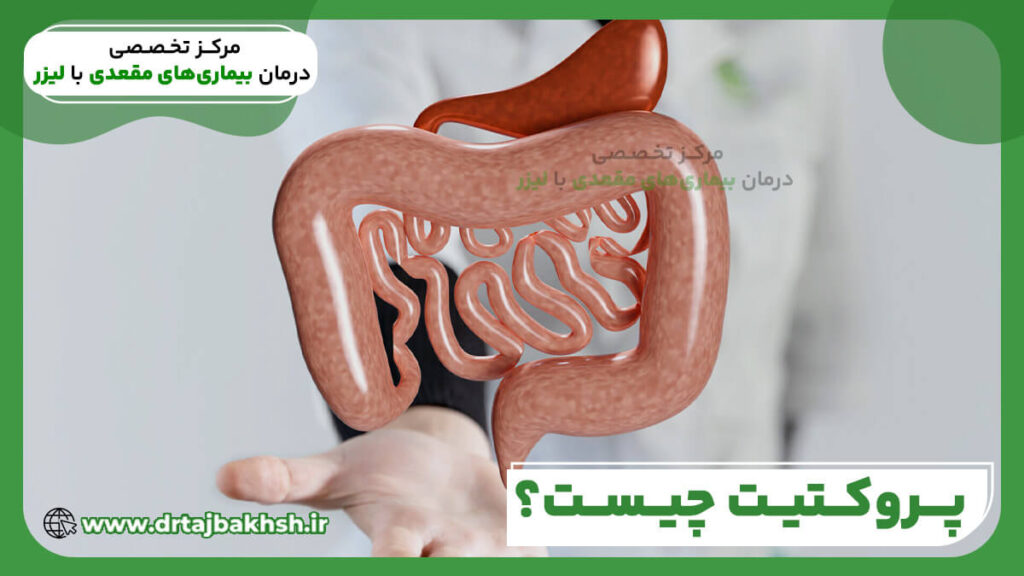 پروکتیت چیست