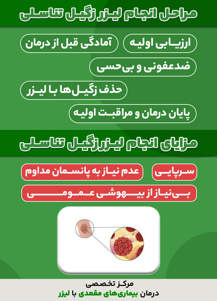 مراحل انجام لیز زگیل تناسلی