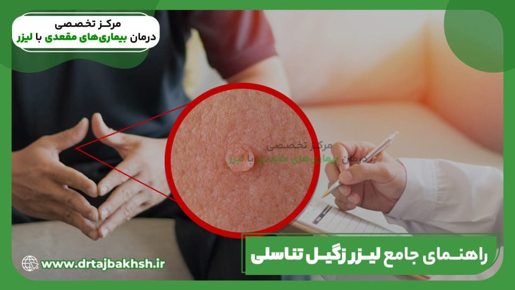 راهنمای جامع لیز زگیل تناسلی