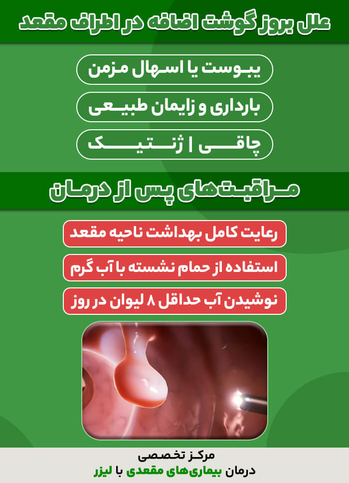 علت بروز گوشت اضفه مقعدی
