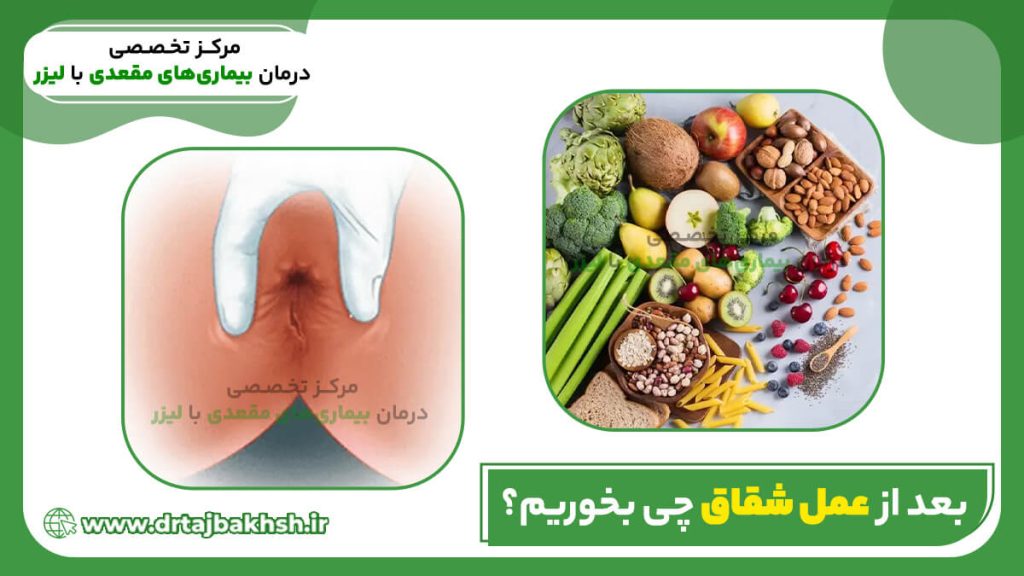 تصویر اصلی بعد عمل شقاق چی بخوریم؟