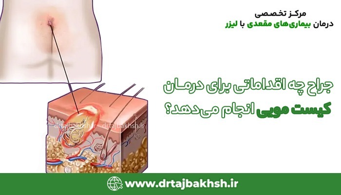 کیست مویی کجا تشکیل میشود