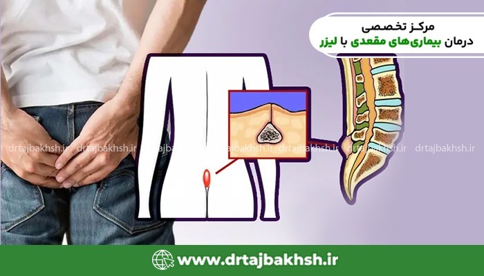 محل کیست مویی