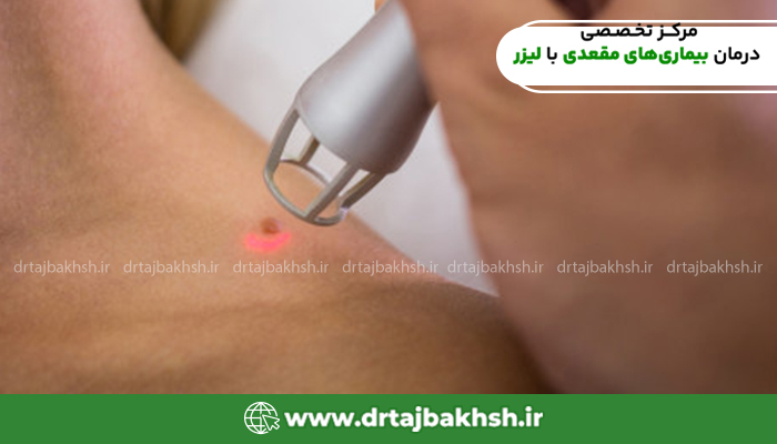 عکس زگیل دست و پا کودکان