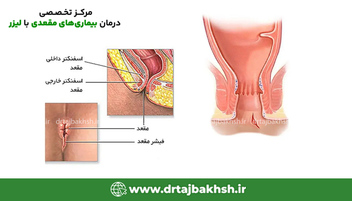عکس باسن خشکی زده