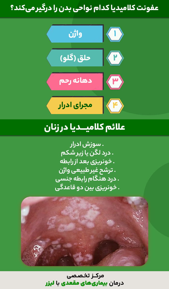 نمودار آموزشی نواحی درگیر عفونت کلامیدیا در بدن زنان و لیست علائم اصلی آن مانند سوزش ادرار و درد لگن