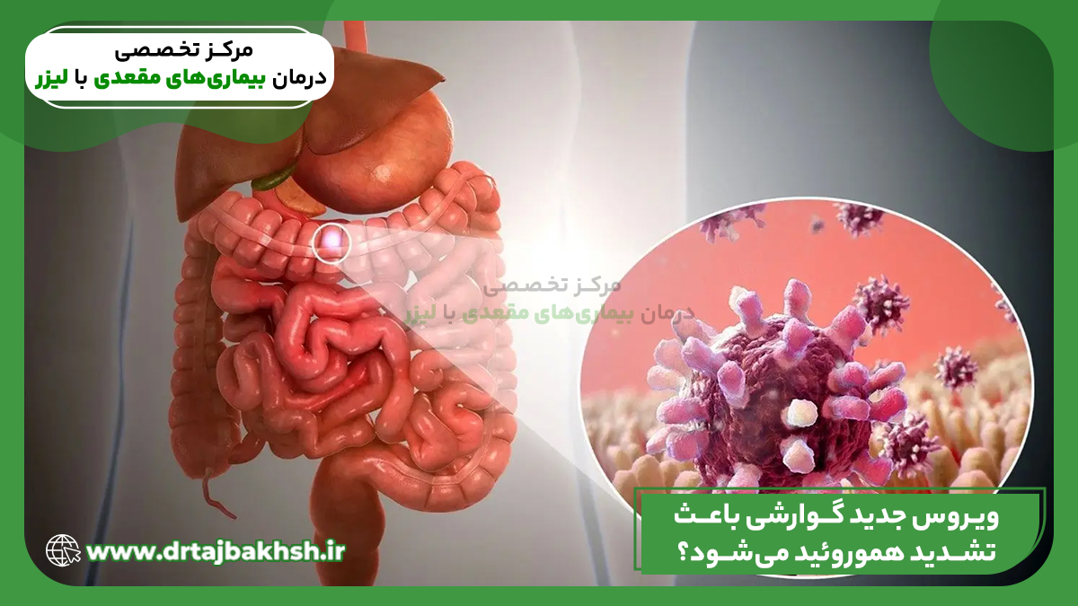 آیا ویروس جدید گوارشی باعث تشدید هموروئید می شود؟