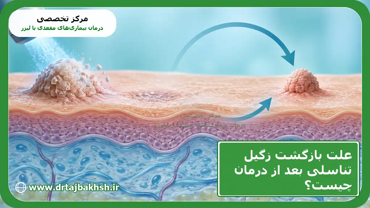 کاور علت بازگشت زگیل تناسلی پس از درمان با عنوان مقاله و نام مرکز تخصصی درمان بیماریهای مقعدی با لیزر