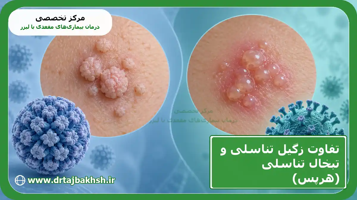 کاور مقایسه زگیل تناسلی و تبخال تناسلی با عنوان مقاله و نام مرکز تخصصی درمان بیماریهای مقعدی با لیزر